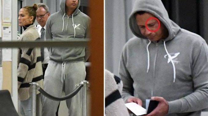 Jennifer Lopez's new fiance Alex Rodriguez sports black eye after cheating rumours threw shadow over their