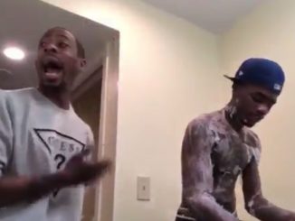 Dude Pulls A Skin Peeling Prank On His Step Father