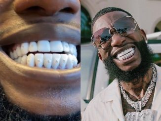 Gucci Mane Drops $250k On Diamond-Studded Teeth