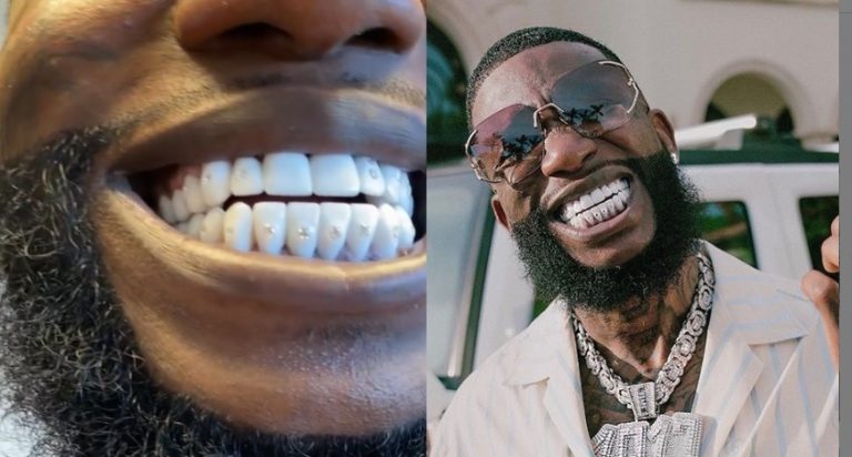 Gucci Mane Drops 250k On Diamond Studded Teeth 768x412 