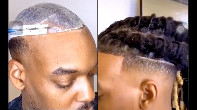 Video Shows Guy's Hair Transformation...And It's Mind Blowing