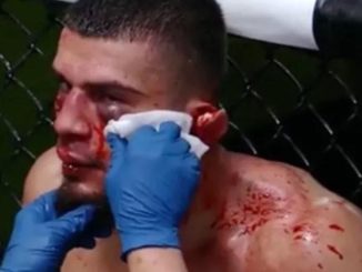 UFC Pro Fighter Nearly Loses His Ear During Bloody Battle