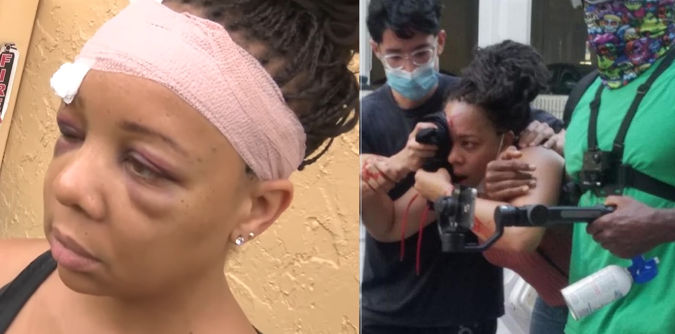 Florida Officer Cleared After Shooting Protestor LaToya Ratlieff In The Eye With Rubber Bullet