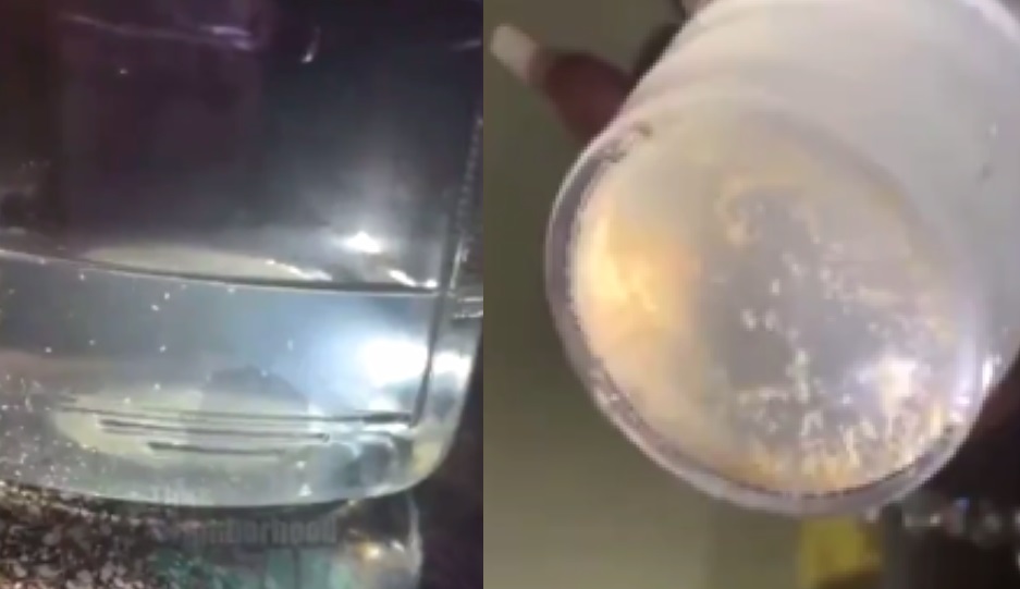 Texas Woman Posted a Video Shows Parasites Swimming In Tap Water