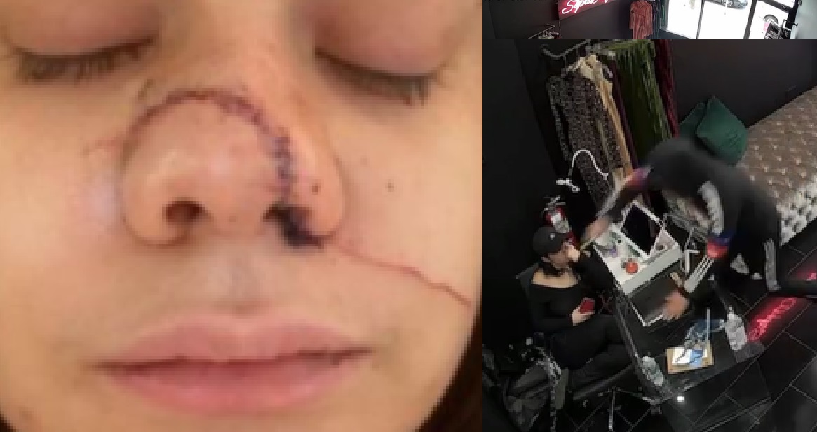 Horrifying Video Shows Store Manager Being Slashed Across Her Face In NYC