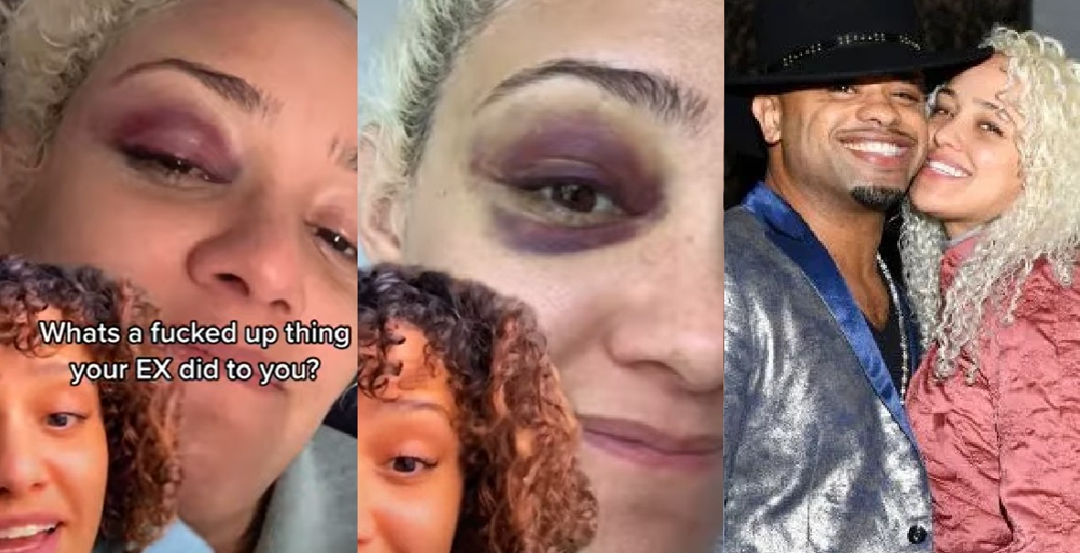 Raz B Of B2K Ex-Girlfriend Exposes Him For Alleged Abuse On Her...Black Eye and All