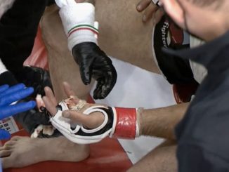 MMA Fighter Loses His Finger During Match