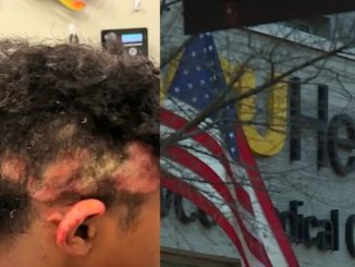 Teen Charged After Allegedly Setting 13-Year-Old Student's Hair on Fire in Class
