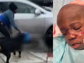 Disturbing Video: 5-Year-Old Autistic Boy Attacked by 2 Dogs Saved by Good Samaritan in Philadelphia