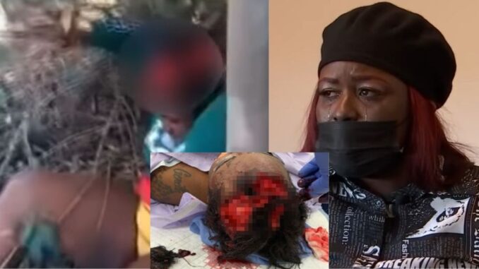 Graphic: Disturbing Bodycam Video Shows Woman's Head After Dog Bites The Top of Her Skull; Lawsuit
