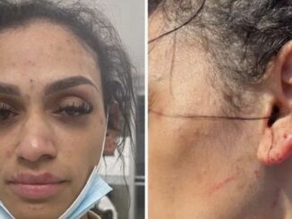 NBA Player Miles Bridge's Wife Shares Disturbing Photos of Reported Assault