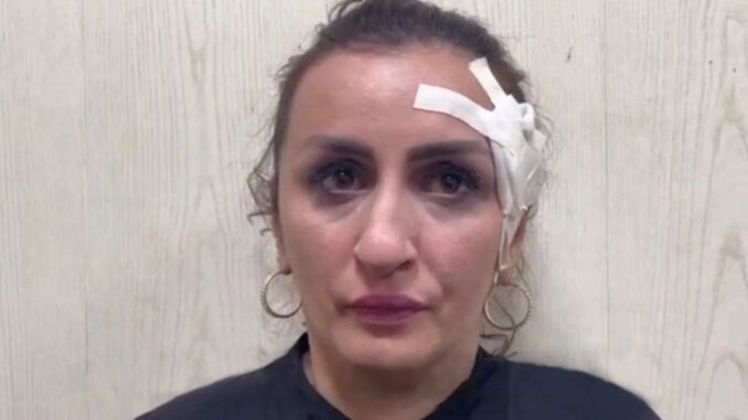 Mother Arrested After Allegedly Selling Newborn to Pay for Nose Job